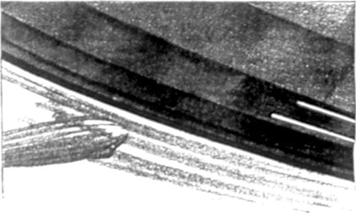 The body went twisting and turning into the gulf
below.